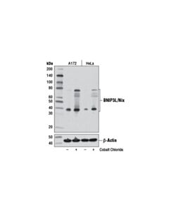 Cell Signaling BNIP3L/Nix (D4R4B) Rabbit mAb 20 uL