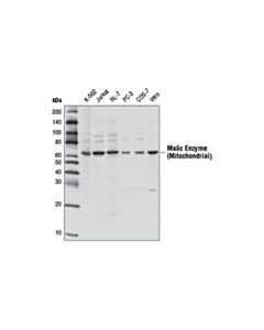 Cell Signaling Malic Enzyme 2 Antibody
