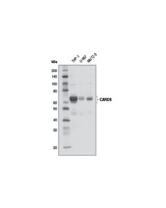 Cell Signaling Card9 Antibody