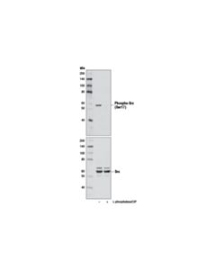 Cell Signaling Phospho-Src (Ser17) (D7f2q) Rabbit mAb