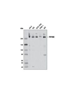 Cell Signaling FIP200 (D10D11) Rabbit mAb 20 uL