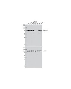 Cell Signaling Caldesmon-1 (D5c8d) Xp Rabbit mAb