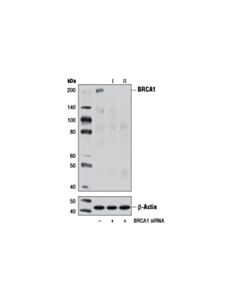 Cell Signaling Signalsilence Brca1 Sirna I