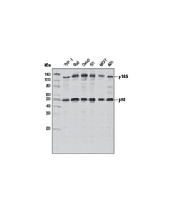 Cell Signaling NF-kappaB1 p105/p50 (D7H5M) Rabbit mAb 20 uL