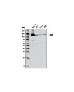 Cell Signaling Eml4 (D5v6m) Rabbit mAb