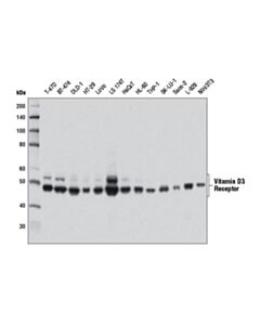 Cell Signaling Vitamin D3 Receptor (D2k6w) Rabbit mAb
