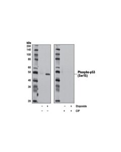 Cell Signaling Phospho-P53 (Ser15) (D4s1h) Rabbit mAb (Rodent Specific)