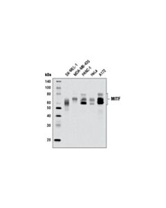Cell Signaling MITF (D5G7V) Rabbit mAb 20 uL