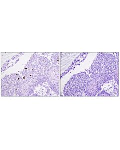 Cell Signaling Signalstain  Apoptosis (Cleaved Caspase-3) Ihc Detection Kit