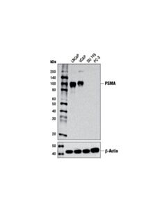 Cell Signaling Prostate Specific Membrane Antigen (D4s1f) Rabbit mAb