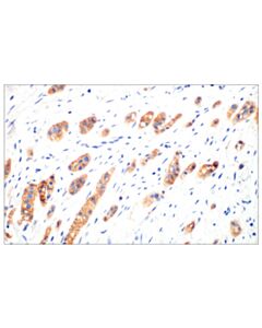 Cell Signaling HER3/ErbB3 (D22C5) Rabbit Monoclonal Antibody
