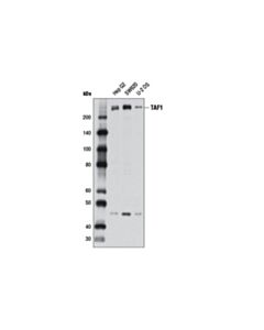 Cell Signaling Taf1 (D6j8b) Rabbit mAb