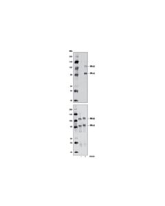 Cell Signaling Phospho-Progesterone Receptor (Ser345) Antibody
