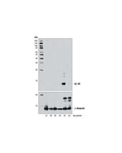 Cell Signaling beta-Amyloid (1-42) (D3E10) Rabbit mAb 20 uL