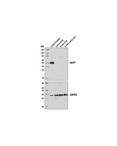 Cell Signaling Prostatic Acid Phosphatase (D3y5p) Rabbit mAb