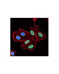 Cell Signaling Dylight 594 Phalloidin