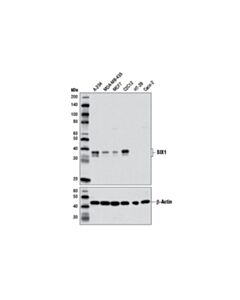 Cell Signaling SIX1 (D4A8K) Rabbit mAb 20 uL