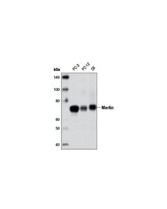 Cell Signaling Merlin (D6n8h) Rabbit mAb