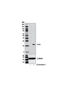 Cell Signaling Il-6 (D5w4v) Xp Rabbit mAb (Mouse Specific)