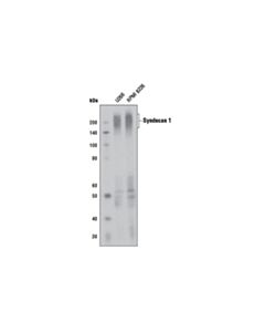 Cell Signaling Syndecan 1 (D4y7h) Rabbit mAb