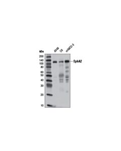 Cell Signaling EphA2 (8B6) Mouse mAb 20 uL