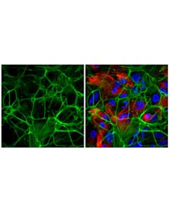 Cell Signaling Dylight 488 Phalloidin