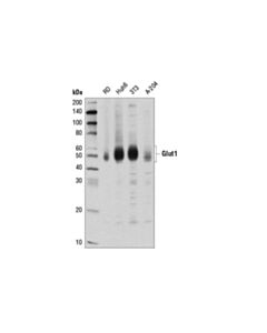 Cell Signaling Glut1 (D3j3a) Rabbit mAb