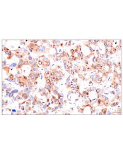 Cell Signaling Catalase (D4p7b) Xp Rabbit mAb