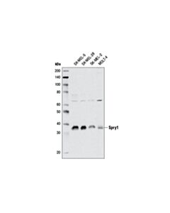 Cell Signaling Spry1 (D9v6i) Rabbit mAb