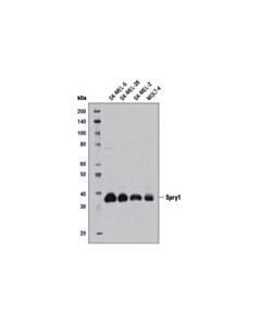 Cell Signaling Spry1 (D9v6p) Rabbit mAb