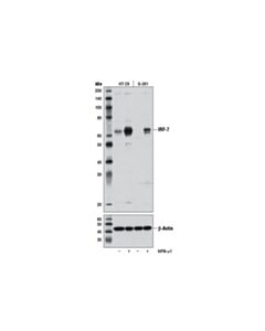 Cell Signaling IRF-7 (D2A1J) Rabbit mAb 20 uL