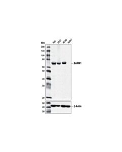 Cell Signaling Sarm1 (D2m5i) Rabbit mAb