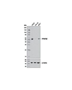 Cell Signaling PFKFB2 (D5I5F) Rabbit mAb 20 uL