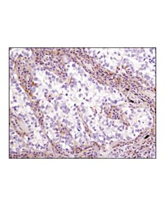 Cell Signaling Lkb1 (D60c5f10) Rabbit mAb (Ihc Formulated)