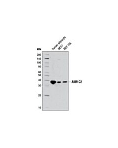 Cell Signaling Akr1c2 Antibody