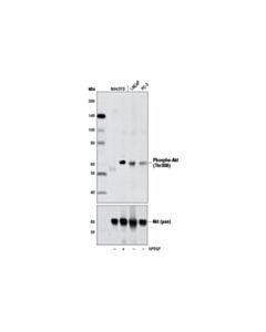 Cell Signaling Phospho-Akt (Thr308) (D25e6) Xp Rabbit mAb