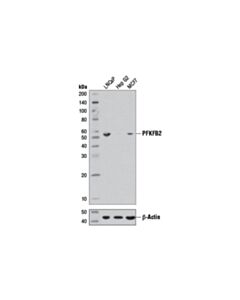 Cell Signaling PFKFB2 (D7G5R) Rabbit mAb 20 uL