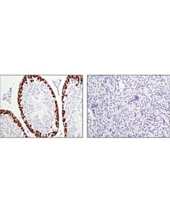 Cell Signaling Dazl (D2a4) Rabbit mAb (Ihc Specific)