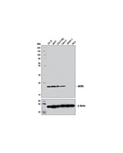 Cell Signaling Agr2 (D9v2f) Xp Rabbit mAb