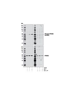 Cell Signaling Phospho-PFKFB2 (Ser483) (D4R1W) Rabbit mAb 20 uL