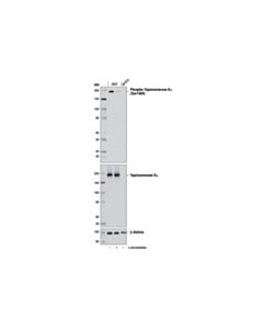 Cell Signaling Phospho-Topoisomerase Iialpha (Ser1469) (D4f5) Rabbit mAb