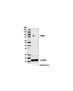 Cell Signaling Wee1 (D10d2) Rabbit mAb