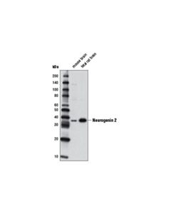 Cell Signaling Neurogenin 2 (D2r3d) Rabbit mAb