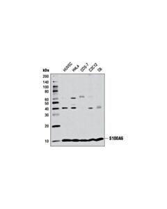 Cell Signaling S100A6 (D3H3W) Rabbit mAb 20 uL