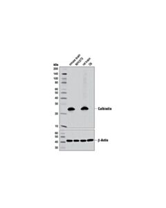 Cell Signaling Calbindin (D1i4q) Xp Rabbit mAb