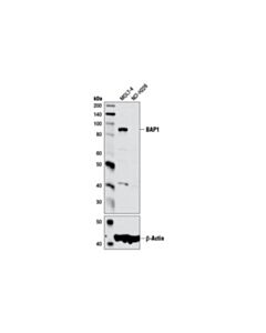 Cell Signaling Bap1 (D1w9b) Rabbit mAb