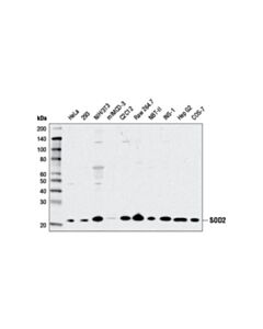 Cell Signaling SOD2 (D9V9C) Rabbit mAb 20 uL