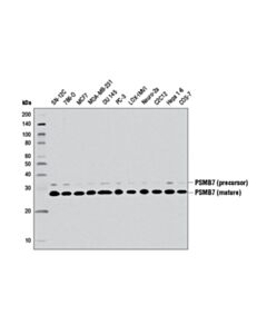 Cell Signaling Psmb7 (E1l5h) Rabbit mAb