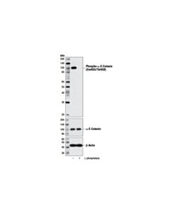 Cell Signaling Phospho-Alpha-E-Catenin (Ser655/Thr658) Antibody