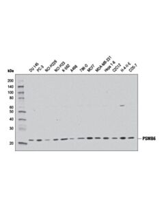 Cell Signaling Psmb6 (E1k9o) Rabbit mAb